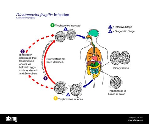  Dientamoeba! Un Parásito Invisible que Habita en Nuestro Intestino