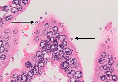  Cryptosporidium: ¡Un parásito microscópico que causa estragos en el tracto intestinal!